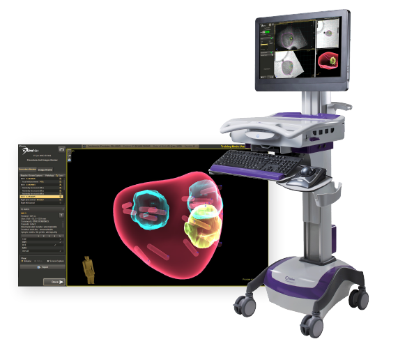 UroNav-MR-Ultrasound-Biopsy-Laser