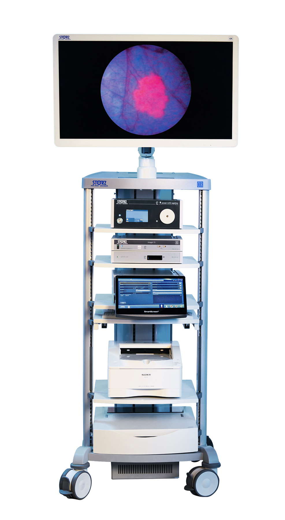 Blue light cystoscopy fortec medical